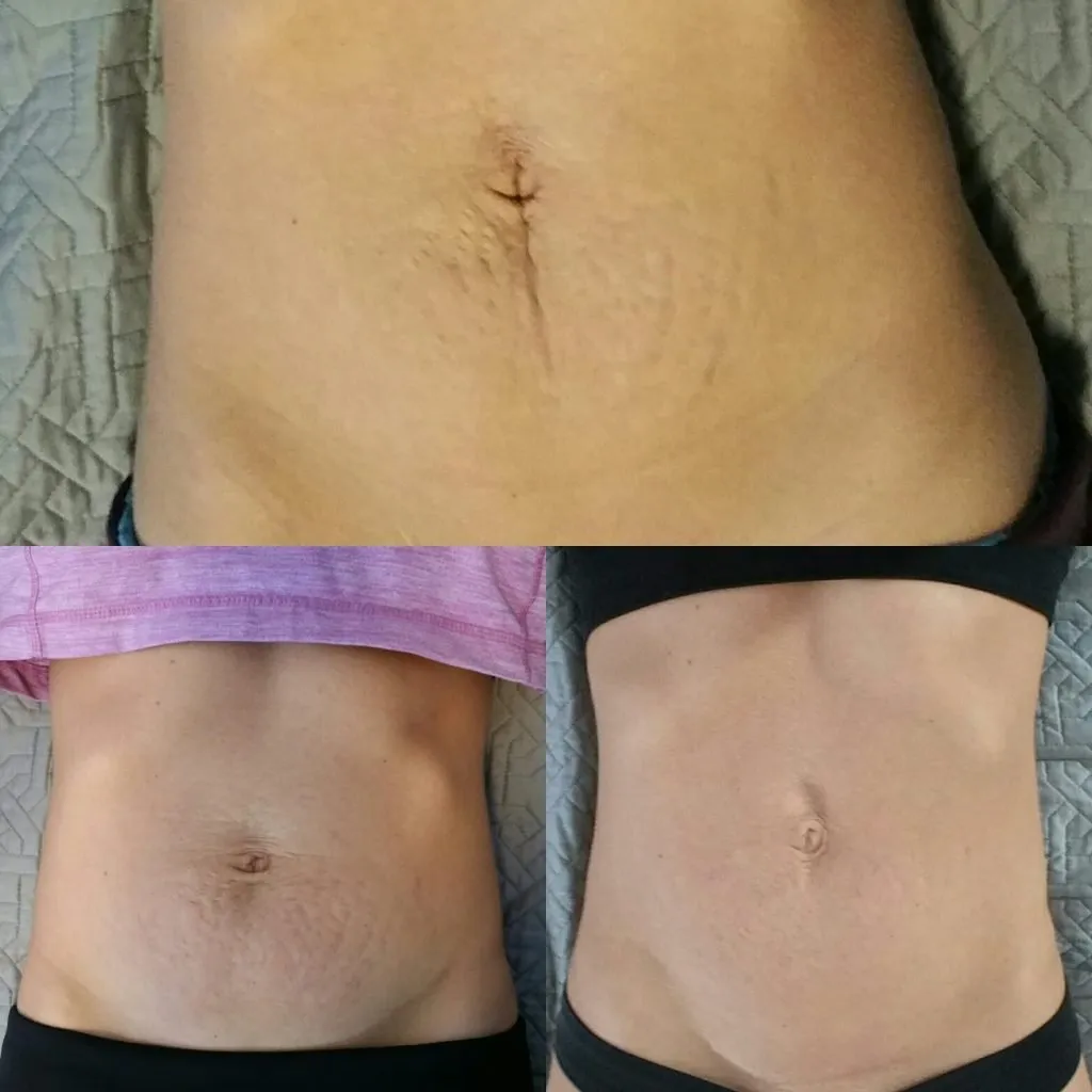 Before and After Results